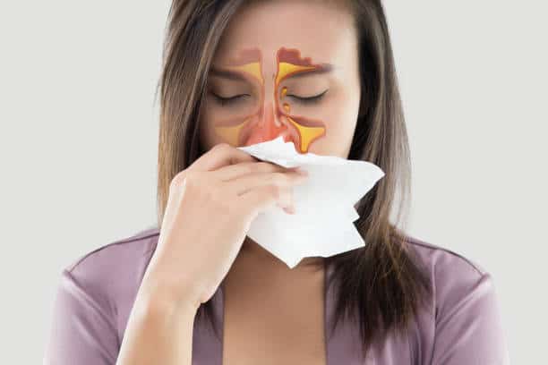 sinusitis